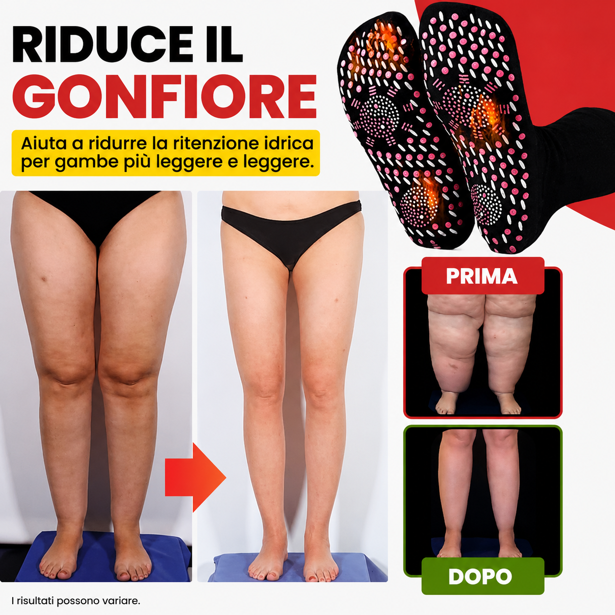 Calzini Anti-Varici™ – Migliora la Circolazione e Allevia il Dolore alle Gambe