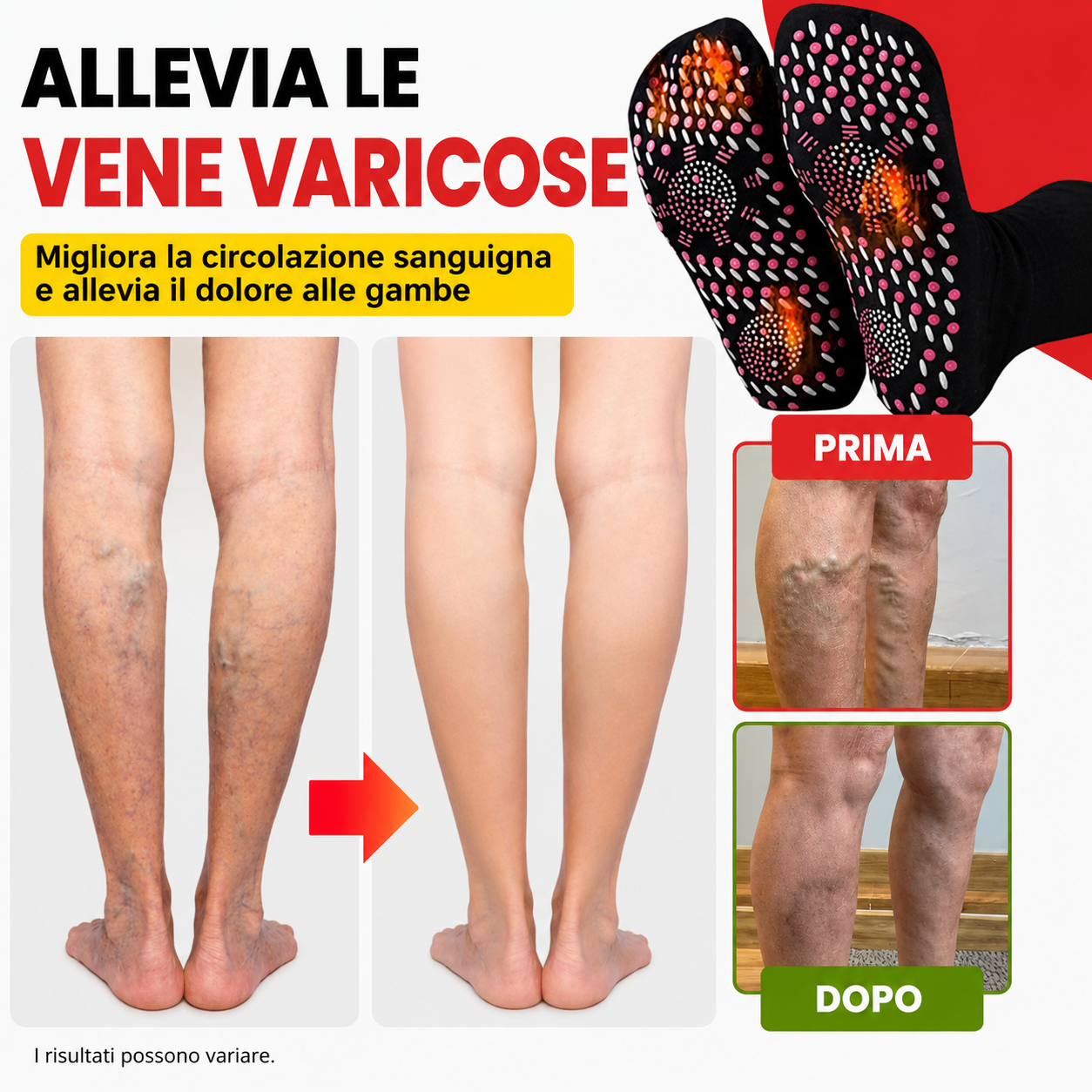 Calzini Anti-Varici™ – Migliora la Circolazione e Allevia il Dolore alle Gambe