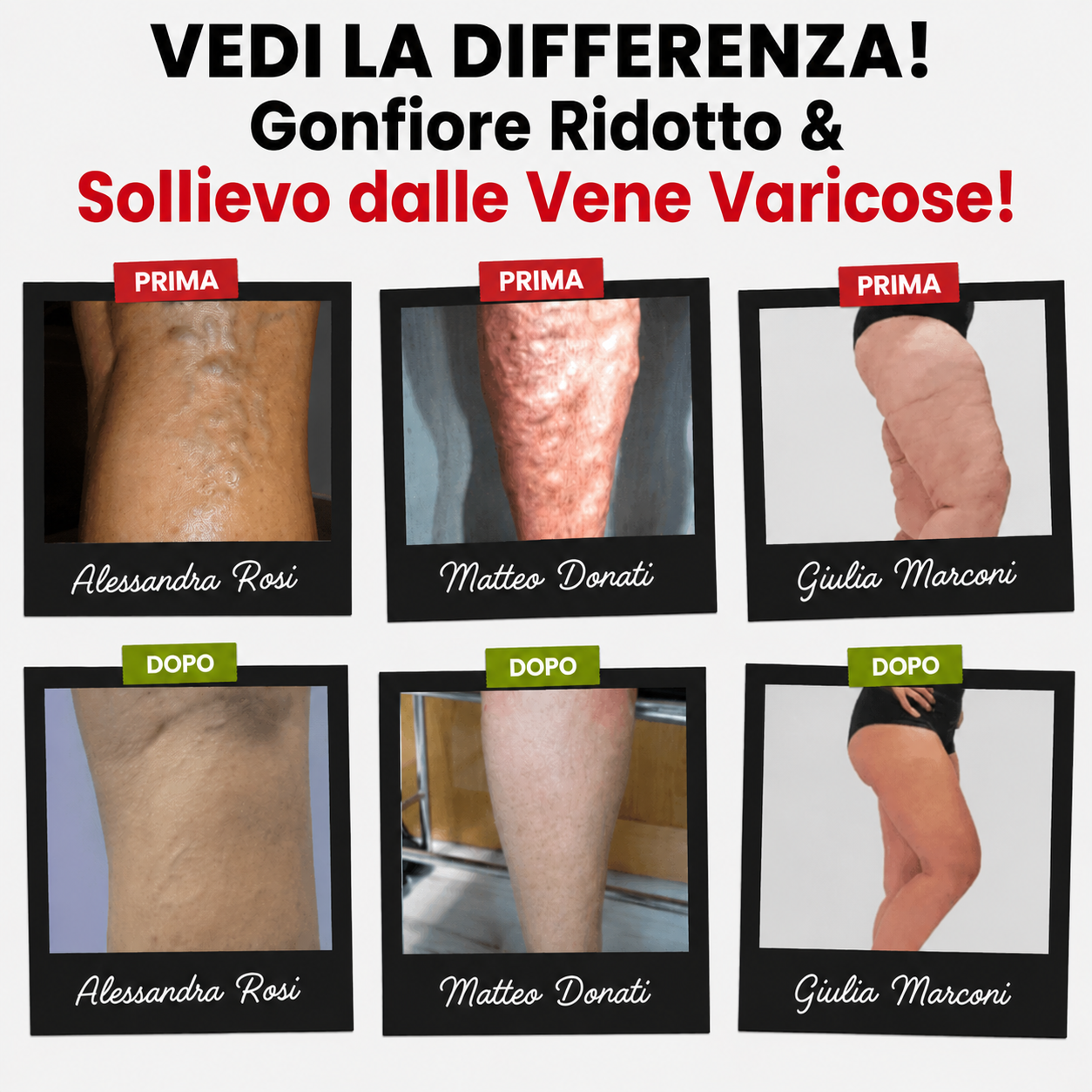 Calzini Anti-Varici™ – Migliora la Circolazione e Allevia il Dolore alle Gambe